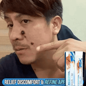 My-gif-skin2